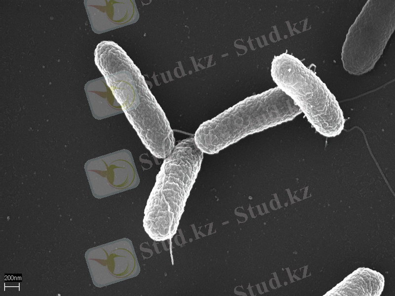 https://upload.wikimedia.org/wikipedia/commons/e/ee/Salmonella_typhimurium.png