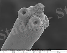 https://upload.wikimedia.org/wikipedia/commons/thumb/2/27/Hymenolepis_microstoma.jpg/220px-Hymenolepis_microstoma.jpg