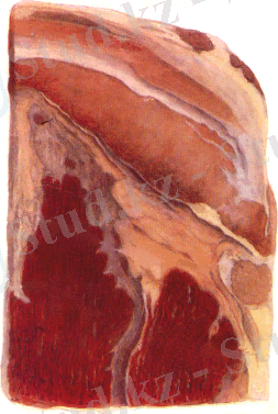 http://www.kgau.ru/distance/vet_03/patanatomia/img/ris169.gif