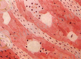 http://www.kgau.ru/distance/vet_03/patanatomia/img/ris170.gif