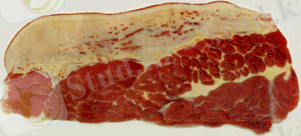 http://www.kgau.ru/distance/vet_03/patanatomia/img/ris171.gif