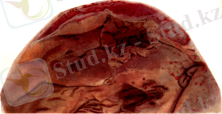 http://www.kgau.ru/distance/vet_03/patanatomia/img/ris172.gif