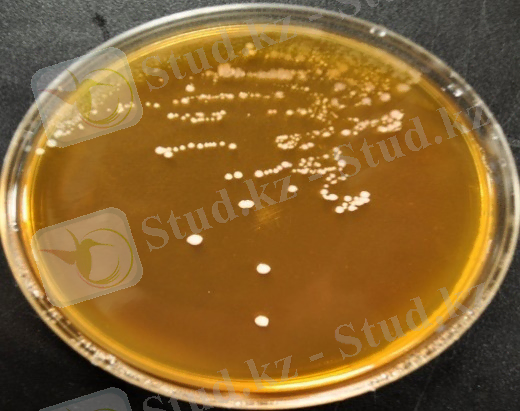 https://iridescentscribblings.files.wordpress.com/2012/06/pediococcus.jpg