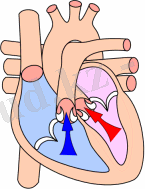 Heart_systole