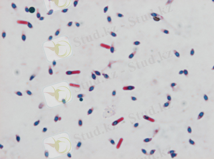 http://fvl.vfu.cz/sekce_ustavy/mikrobiologie/obrazova_priloha/mikrob/img/14-11.jpg