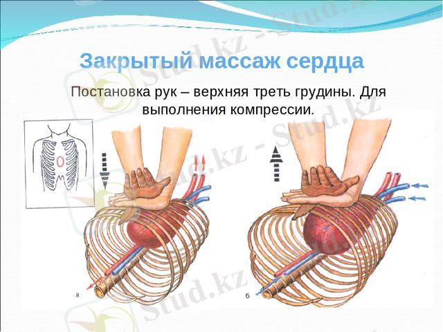 Кескін