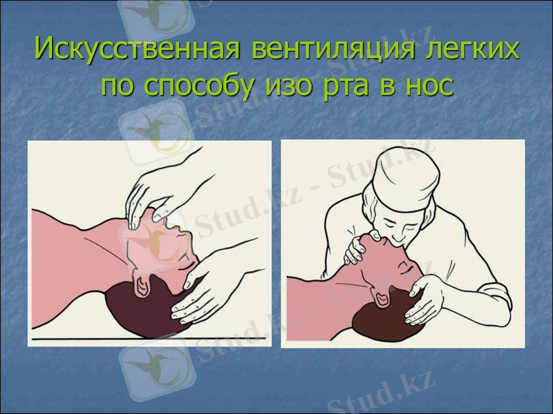 Кескін