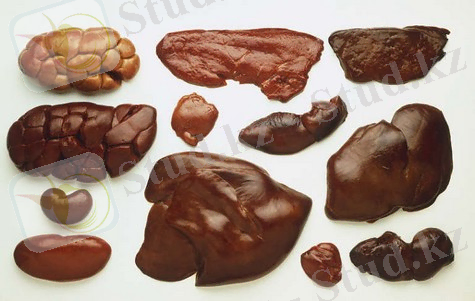 http://www.santim-spb.ru/uploads/images/sub.jpg