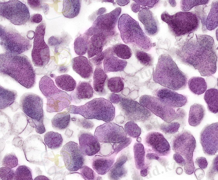 http://liqmed.ru/wp-content/uploads/2017/01/mycoplasma-genitalium.jpg