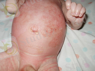 http://medico.ru/medatlas/post/1113247471_02_168_1_s.jpg