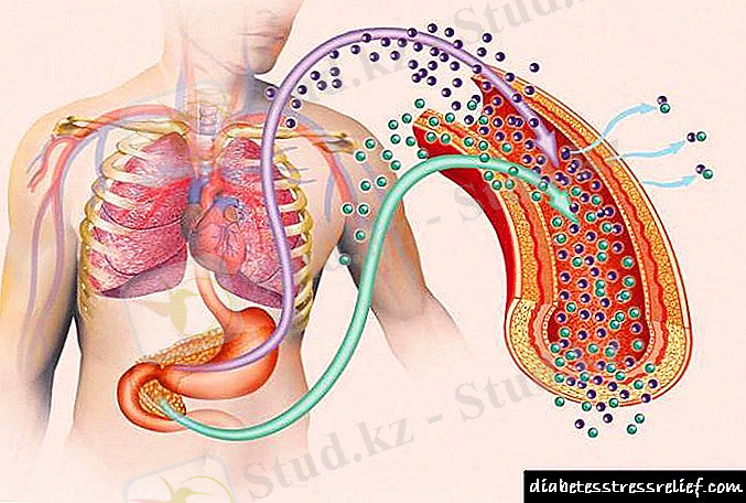 C:\Users\ДИНАРА\Desktop\etiologiyapatogeneziklinikasaxarnogodiab_1C473D22.jpg
