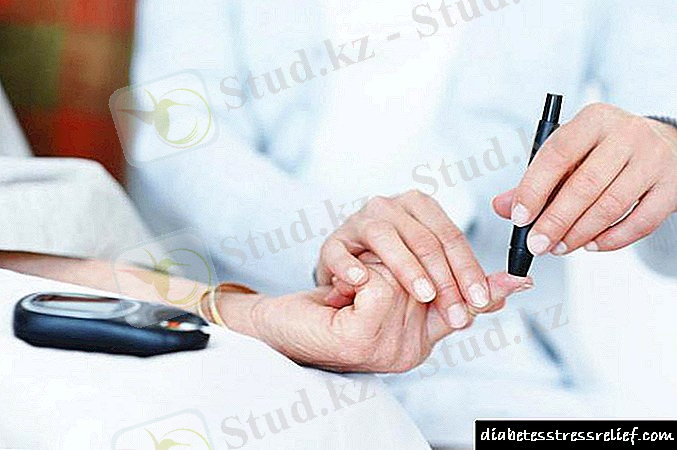 C:\Users\ДИНАРА\Desktop\etiologiyapatogeneziklinikasaxarnogodiab_F6994BBA.jpg