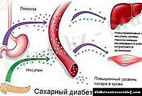 C:\Users\ДИНАРА\Desktop\patogenezietiologiyasaxarnogodiabeta_2FE0370D.jpg