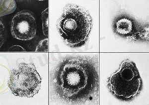 http://upload.wikimedia.org/wikipedia/commons/thumb/4/4d/Herpesviridae_EM_PHIL_2171_lores.jpg/300px-Herpesviridae_EM_PHIL_2171_lores.jpg