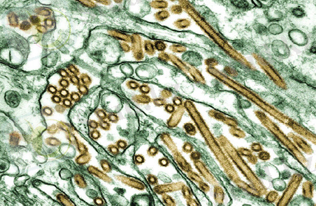 C:\Users\User\Desktop\mikrofotografii-ptichego-grippa-h5n1.jpg