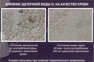 http://zozh.kz/images/stories/pitanie/image-4.jpg