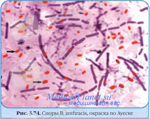 http://medicalplanet.su/Img/389.jpg