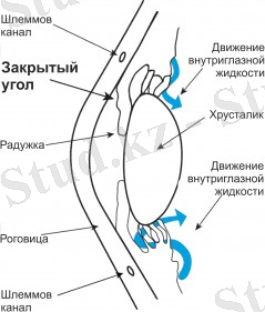 puzg1-239x300