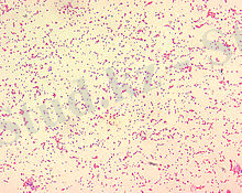 https://upload.wikimedia.org/wikipedia/commons/thumb/f/fa/Brucella_spp.JPG/220px-Brucella_spp.JPG