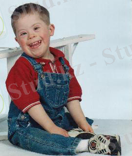 D:\USER\Desktop\down_syndrome_270.jpg