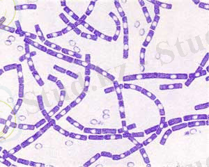 http://www.collegemicrob.narod.ru/diagnostik/img/B.anthracis.jpg