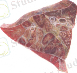 http://www.kgau.ru/distance/vet_03/patanatomia/img/ris144.jpg