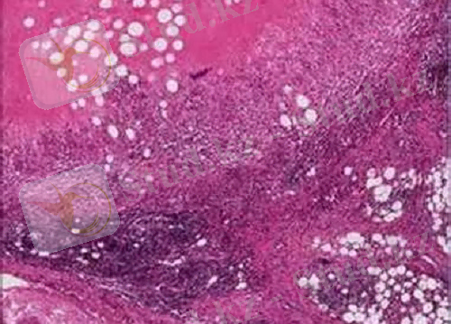 http://med36.com/files/uploads/images/ills/brucellosis.jpeg