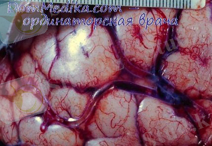 http://dommedika.com/phisiology/Pic/1113.jpg