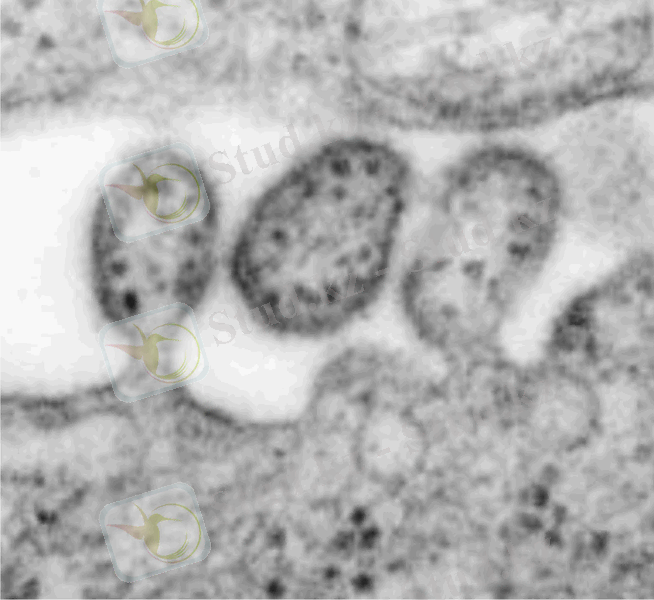 http://gsdl.bvs.sld.cu/greenstone/collect/clnicos/index/assoc/HASH7269.dir/fig02a07.png