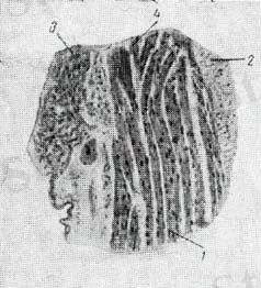 image32