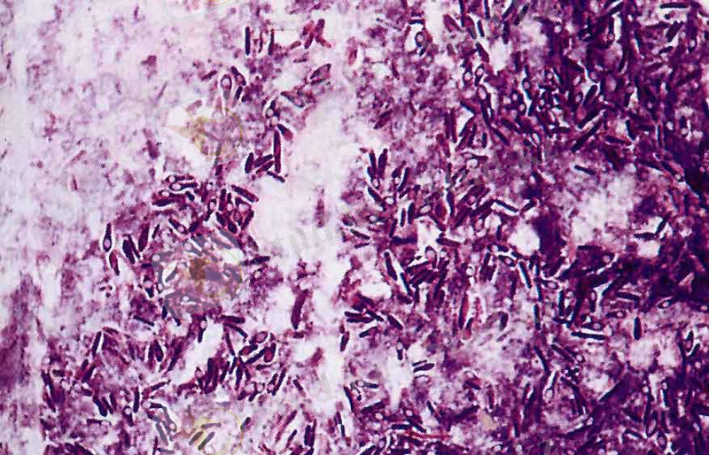 http://nsau.edu.ru/images/vetfac/images/ebooks/microbiology/stu/micro/pict/anaerob12_l.jpg
