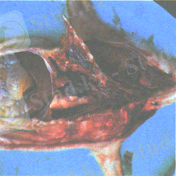 http://www.kgau.ru/distance/vet_03/patanatomia/img/ris136.gif