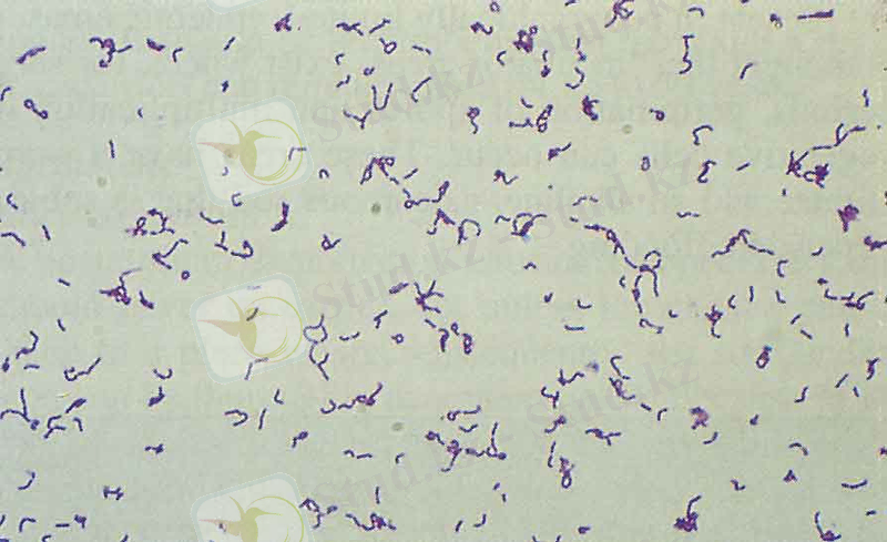 http://nsau.edu.ru/images/vetfac/images/ebooks/microbiology/stu/micro/pict/rogasv2_l.jpg