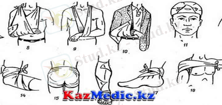 http://kazmedic.kz/wp-content/uploads/2015/11/desmurgya.jpg