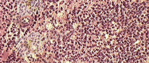 http://www.abyfish.ru/sites/default/files/Page/bolezn_aueski.jpg