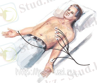 http://images.ru.prom.st/16552965_w640_h640_ekg4.jpg