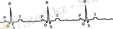 http://www.encyclopedia.sun-clinic.co.il/i/Image150.gif