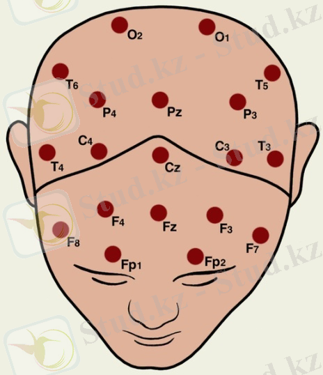 http://dic.academic.ru/pictures/enc_medicine/0243621717.jpg