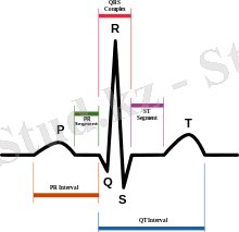 SinusRhythmLabels.svg.png
