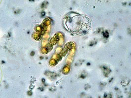 https://upload.wikimedia.org/wikipedia/commons/thumb/4/44/Anabaenaspiroides_EPA.jpg/265px-Anabaenaspiroides_EPA.jpg