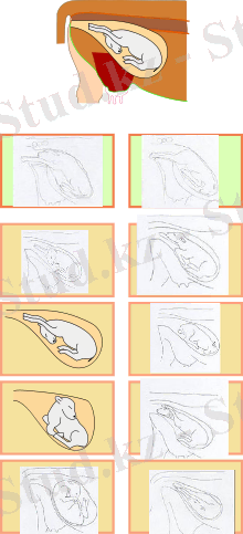 https://upload.wikimedia.org/wikipedia/commons/thumb/9/9a/Cow_foetus-positions_and_dyspositions.svg/220px-Cow_foetus-positions_and_dyspositions.svg.png