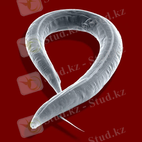 http://svetnsk.ru/foto8.png?i=13315&k=enterobioz-foto
