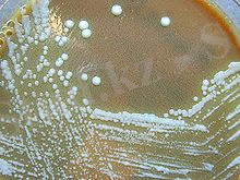 https://upload.wikimedia.org/wikipedia/commons/thumb/7/7a/Francisella_tularensis_01.jpg/220px-Francisella_tularensis_01.jpg