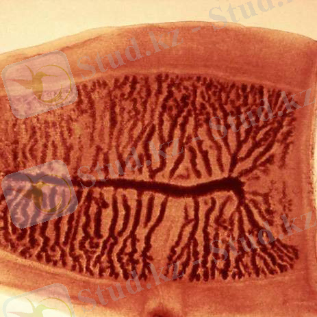 http://upload.wikimedia.org/wikipedia/commons/b/ba/Gravid_proglottid_from_the_cestode_Taenia_saginata_5259_lores.jpg
