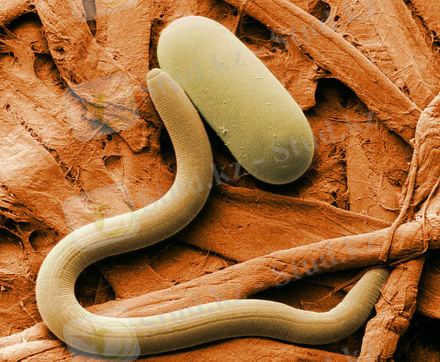 C:\Users\user\Desktop\640px-Soybean_cyst_nematode_and_egg_SEM.jpg
