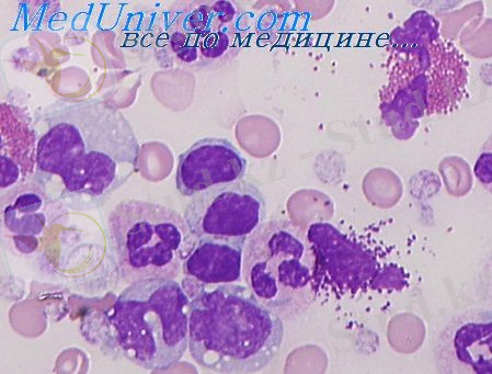http://meduniver.com/Medical/pulmonologia/Img/503.jpg