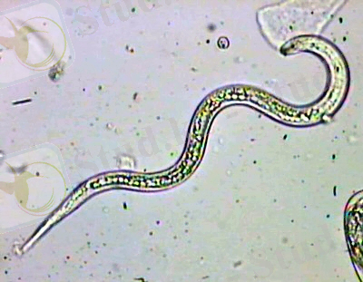 http://deab.upc.edu/img/gdr/epidemiologia/J2%20(2).jpg