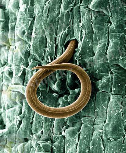 C:\Users\User\Downloads\A_juvenile_root-knot_nematode_(Meloidogyne_incognita)_penetrates_a_tomato_root_-_USDA-ARS.jpg