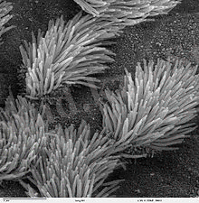 220px-Bronchiolar_epithelium_3_-_SEM.jpg