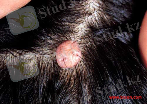 http://www.bioon.com/figure/UploadFiles/200706/200761223754676.jpg